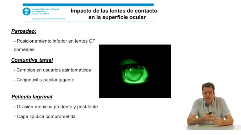 Uso de lentes de contacto y el síndrome del ojo seco