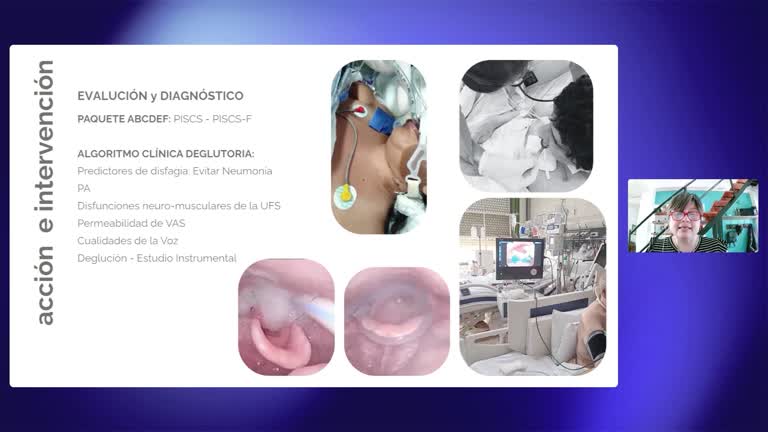 I Congreso Comer con disfagia - Rehabilitación temprana en la UCI e implementación del marco IDDSI en Hospital Público